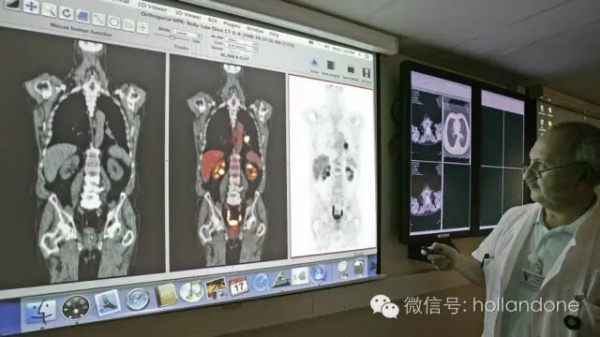 荷兰癌症死亡率降低，绝症变成慢性病